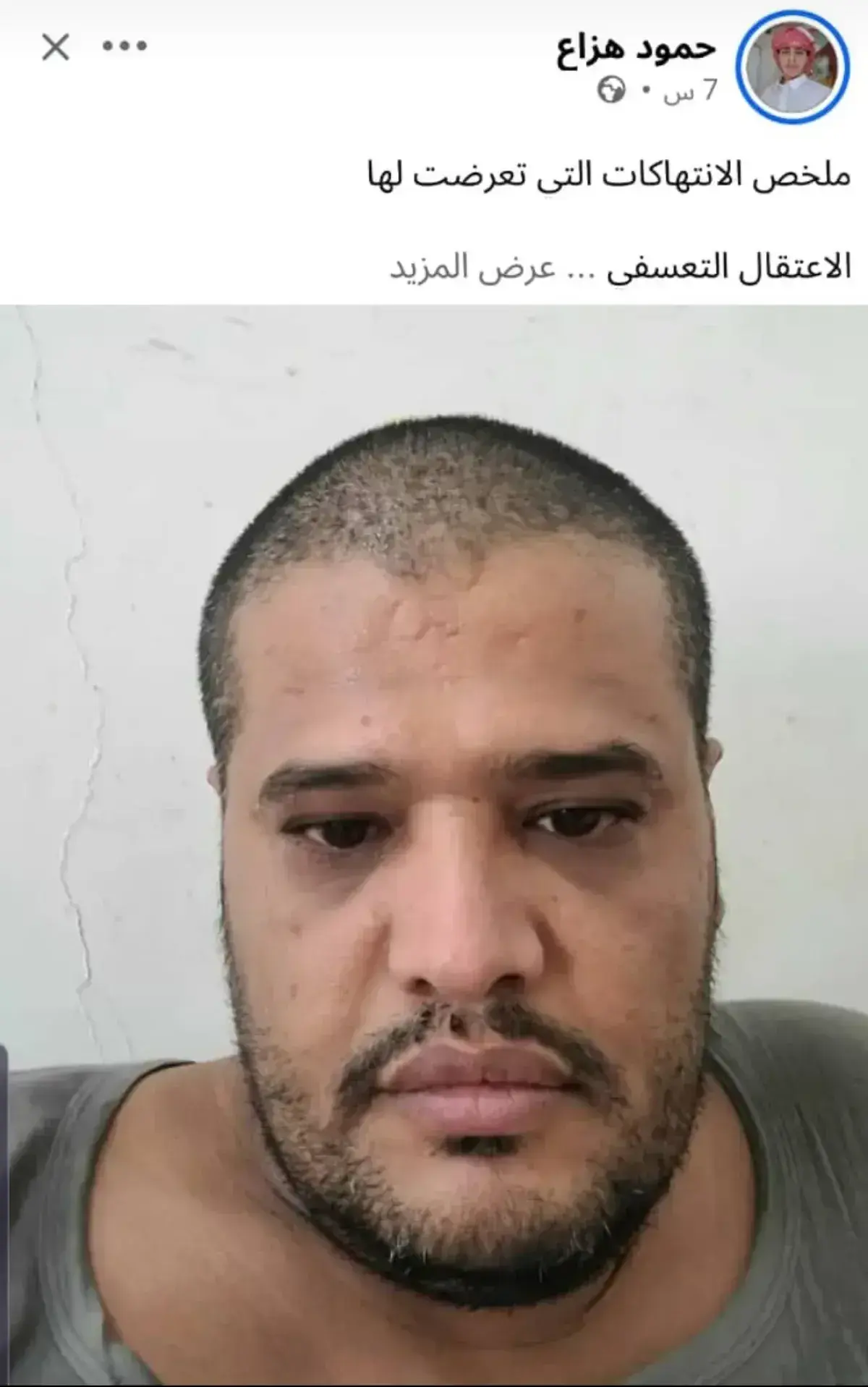 شاهد | صحفي يكشف عن انتهاكات قال إنه تعرض لها في س...