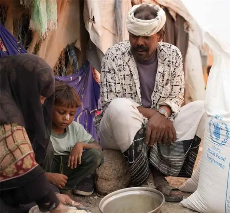 الجوع يتفاقم بمناطق سيطرة ميليشيا الحوثي