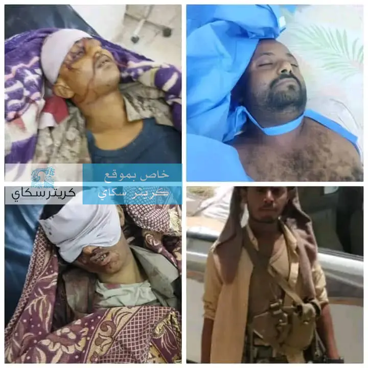 قتلى وجرحى في صفوف قوات درع الوطن بهجوم مسلح مباغت