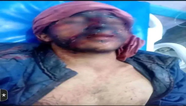 صاعقة تضرب مواطن داخل منزله أثناء استخدامه للهاتف...