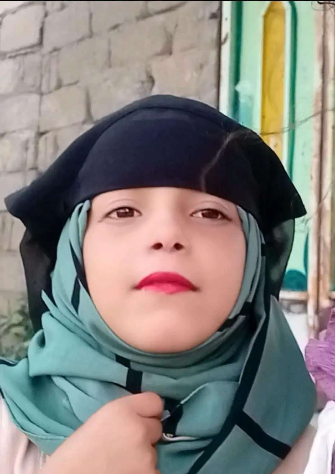 إصابة طفلة بطلق ناري بالرأس اثناء جلبها للماء في الضالع