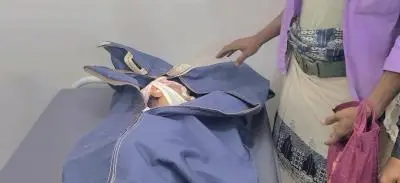شهيدة بقذيفة للمرتزقة في الصلو بتعز