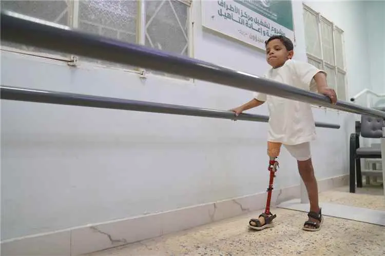 مركز الأطراف الصناعية وإعادة التأهيل بسيئون يقدم أ...