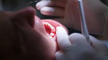 أمراض اللثة قد تنذر بحالة صحية أكثر خطورة مما نتصو...