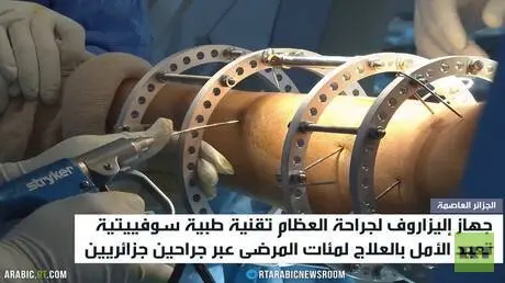 جهاز إليزاروف بأيدي الجراحين الجزائريين