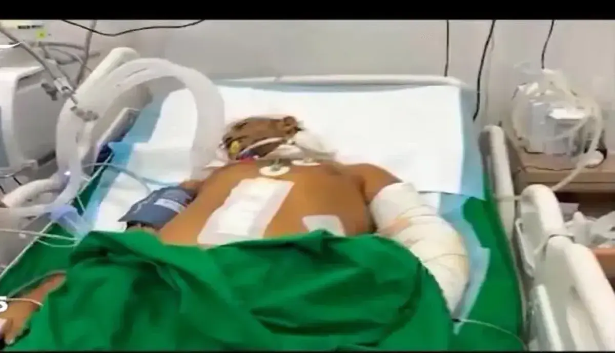 اسرار | جريمة حرب مكتملة الأركان: ميليشيا الحوثي تُجهز على الجرحى وتنزع أجهزة الإنعاش بمستشفيات المخا