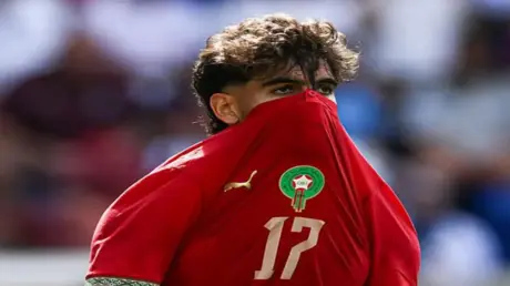 "هذا ليس اعتذارا".. الزلزولي يرد على جدل ارتدائه ق...