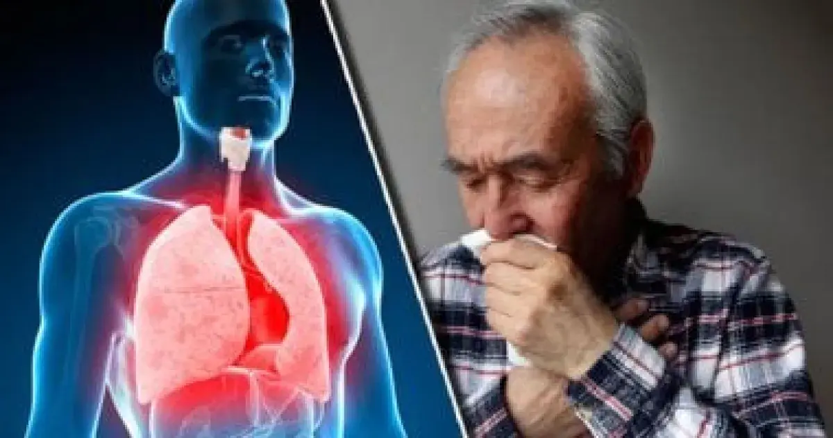 التهاب الشعب الهوائية الحاد: الأعراض، الأسباب، والعلاج