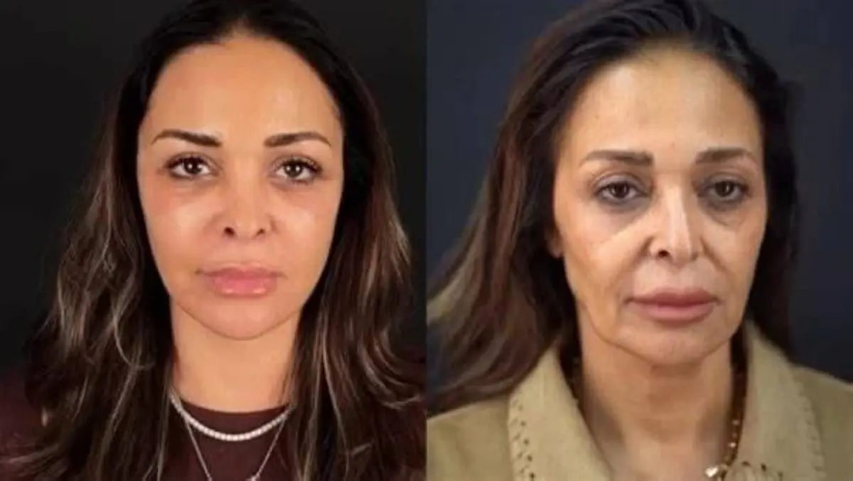 من إليسا إلى غادة عادل.. نجمات اعترفن بتجارب تجميل...