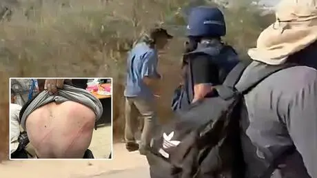 إصابة 4 فلسطينيين بينهم صحفي تعرضوا لاعتداء المستو...