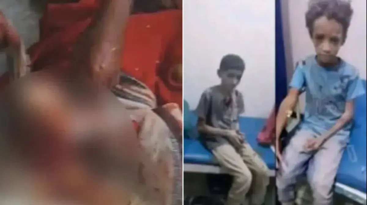 قتلى وجرحى مدنيون في قصف حوثي على تعز ومستشفى يتعر...
