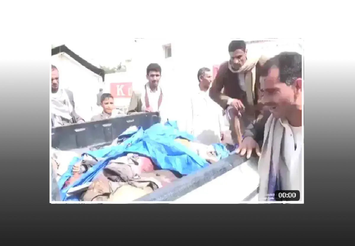 اليمن: مصرع طفل في جبهات القتال.. وجع أب يمزق قلوب...
