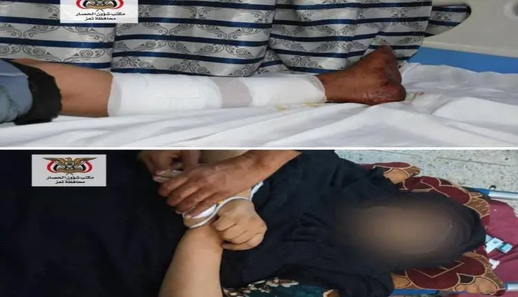 6 قتلى وجرحى مدنيين بينهم طفل وامرأة بقصف وقنص حوث...